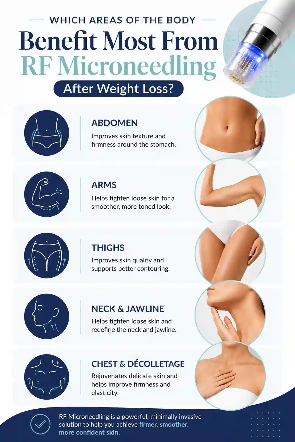 Which Areas of the Body Benefit Most From RF Microneedling After Weight Loss Chesham